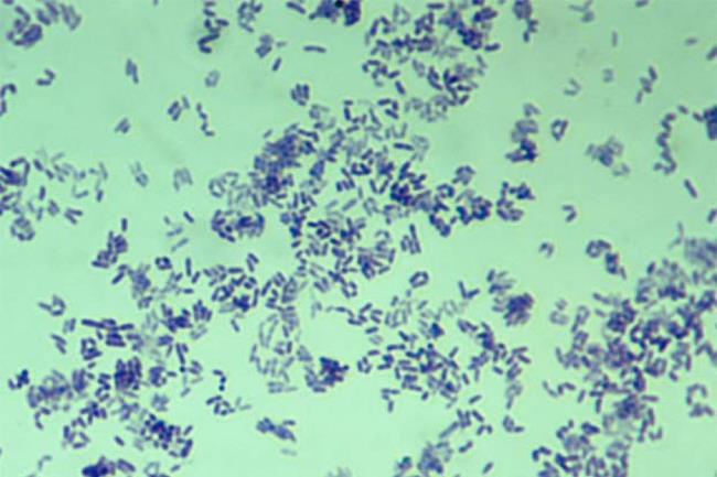 The 10 most common bacteria on mobile phones